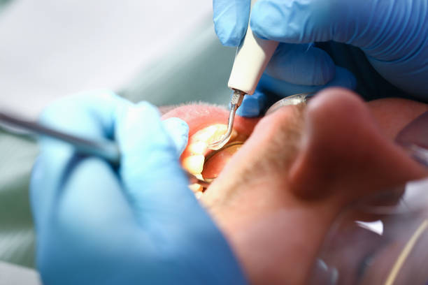 Best Weekend Emergency Dentist in Llender, CA