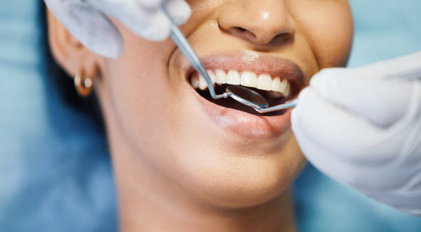 Best Emergency Dental Care for Broken or Chipped Teeth in Llender, CA